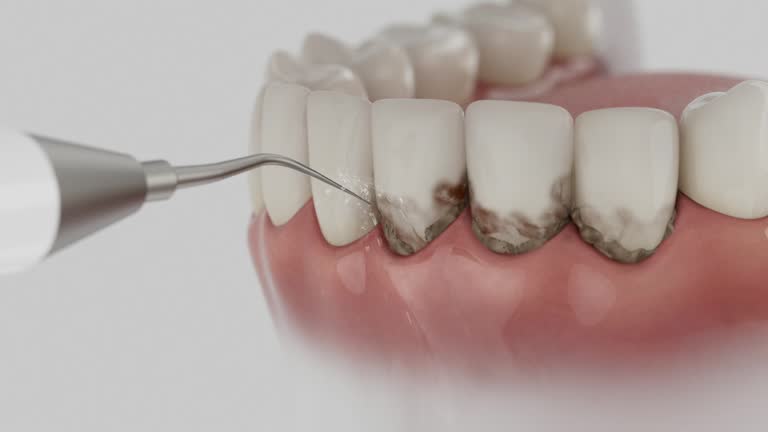 Trusted Dental Crowns And Bridges service in Fairfield, OH - Dentist Open Now